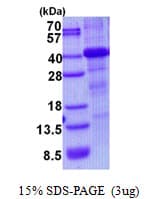 Human HFE Protein (Recombinant His)