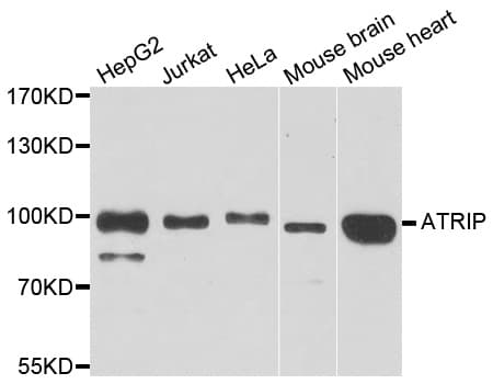 ATRIP Antibody