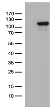 Monoclonal Mouse anti-Human MCF2 / DBL Antibody (clone OTI2C12, aa872-1001, IHC, WB)