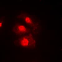 CHEK1 / CHK1 Antibody (phospho-Ser345)
