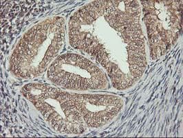 ERBB2 / HER2 Antibody (aa676-1255, clone OTI3F11, Carrier-free)