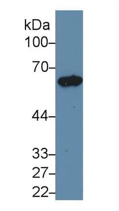 KRT5 / CK5 / Cytokeratin 5 Antibody (aa335-473, Cy3)