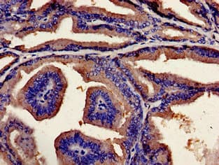 Ubiquilin 2 / UBQLN2 Antibody