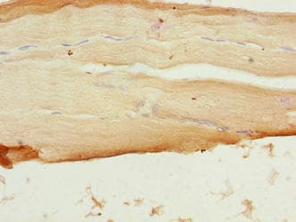 Polyclonal Rabbit anti-Human SFXN4 Antibody (IHC, WB)