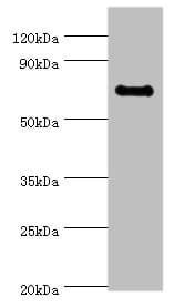 Polyclonal Rabbit anti-Human TAF5L Antibody (aa1-325, WB)