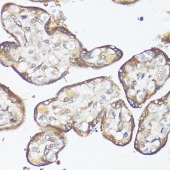 SMAD7 Antibody