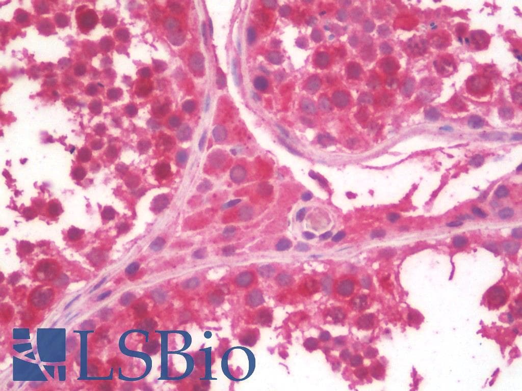 IHC-plus™ KIF11 / EG5 Antibody