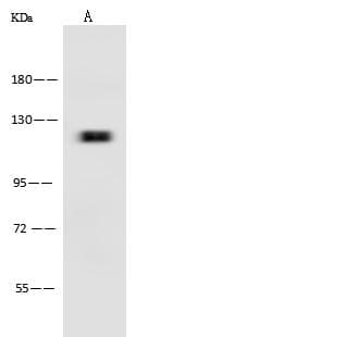 LEPR / Leptin Receptor Antibody