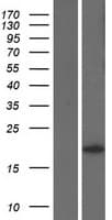 KRAS Protein (Over-Expression Lysate Myc-DDK (Flag))