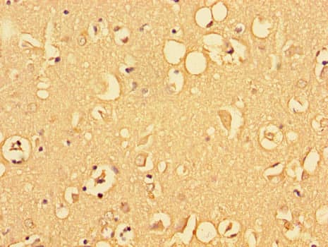 Polyclonal Rabbit anti-Human ALDOC / Aldolase C Antibody (IHC, IF, WB)