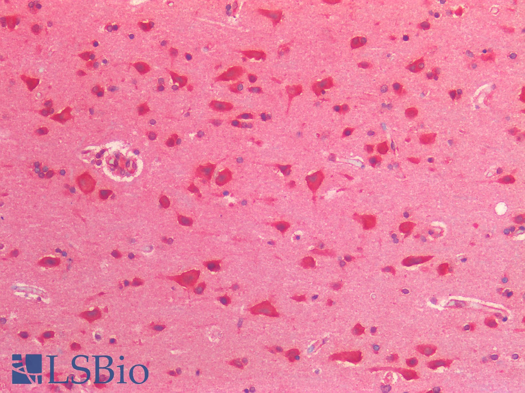 IHC-plus™ Polyclonal Rabbit anti-Human GAD1 / GAD67 Antibody (IHC)