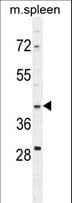 Polyclonal Rabbit anti-Human MAP1D Antibody (aa306-334, WB)