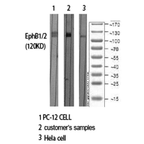 Polyclonal Rabbit anti-Human EPH Receptor B1+B2 Antibody (530-610 aa, IHC, IF, WB)