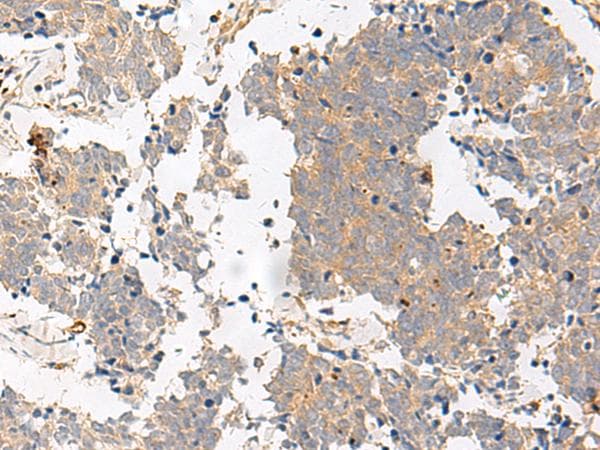 Polyclonal Rabbit anti-Human PGR1 / GPR153 Antibody (IHC)