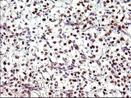 PMS2 Antibody (clone OTI2G5)
