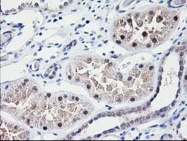 Monoclonal Mouse anti-Human NUBPL Antibody (clone OTI3D11, aa1-250, IHC, WB)