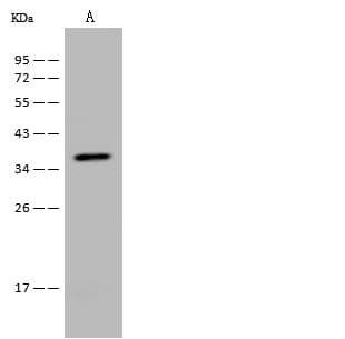 Polyclonal Rabbit anti-Human CFHR1 Antibody (WB)
