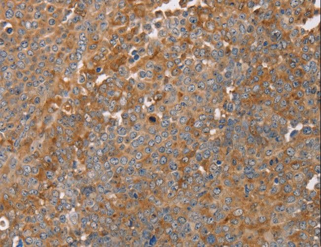 FAIM2 / LIFEGUARD Antibody