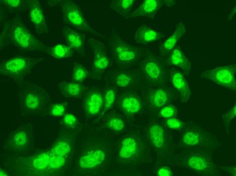 LIG1 / DNA Ligase 1 Antibody