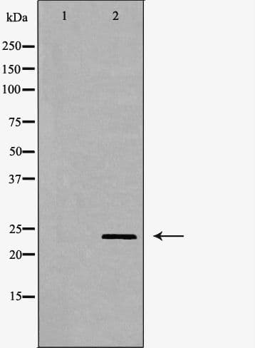 PGF / PLGF Antibody
