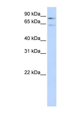 F13B / TGase Antibody (aa216-265, FITC)