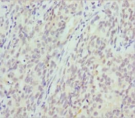 CRYGS Antibody