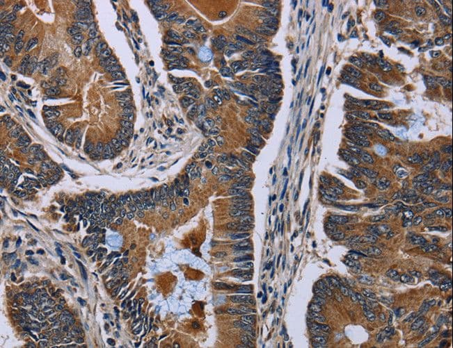 Polyclonal Rabbit anti-Human SLC1A6 / EAAT4 Antibody (IHC, WB)