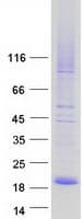 Human CMTM7 / CKLFSF7 Protein (Recombinant Myc-DDK (Flag))