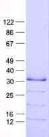 Human ING5 Protein (Recombinant His, N-Terminal)