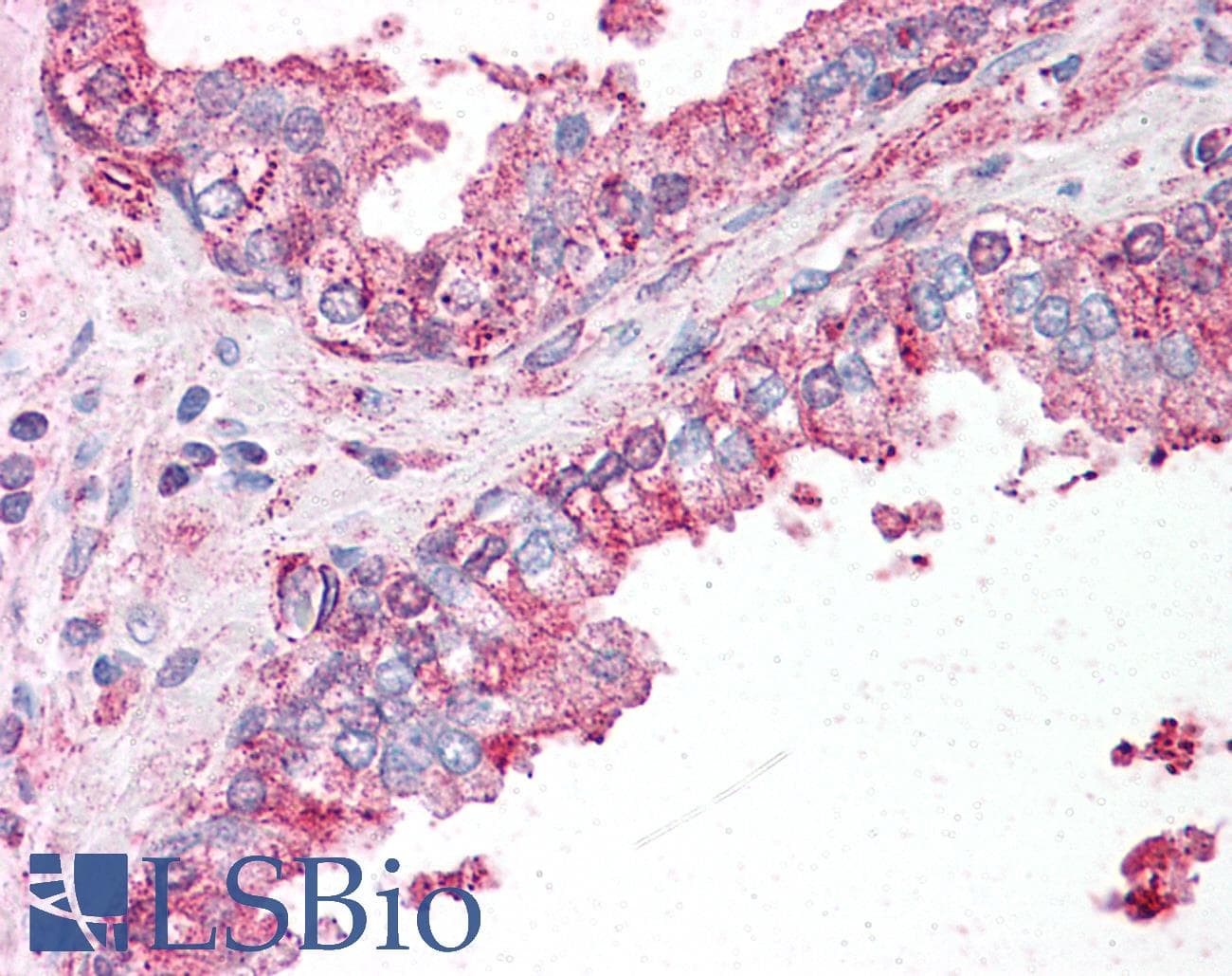 IHC-plus™ SLC39A6 / LIV-1 Antibody (N-Terminus)