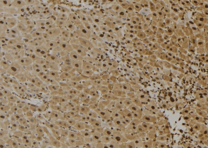 Polyclonal Rabbit anti-Human FAIM Antibody (IHC, WB)