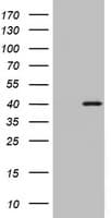 OTC Antibody (aa33-354, clone OTI7B1)