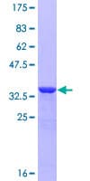 Human PKIB Protein (Recombinant GST)