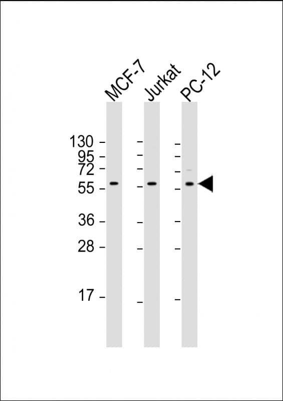 AKT2 Antibody (aa272-481, clone 1623CT791.157.67.66)