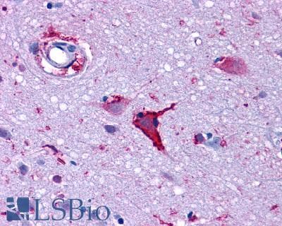 PathPlus™ Polyclonal Rabbit anti-Human GLP1R / GLP-1 Receptor Antibody (N-Terminus, IHC)