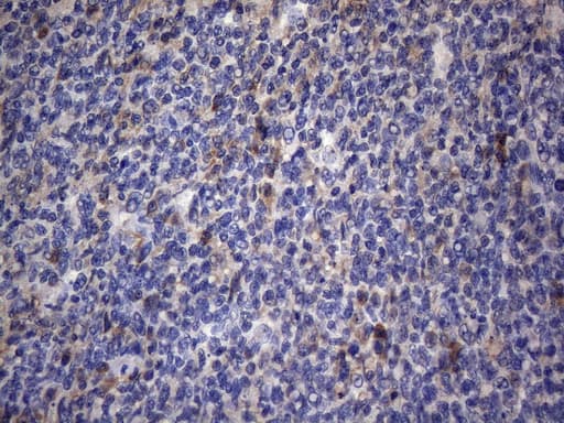 CRP / C-Reactive Protein Antibody (clone OTI4G8)