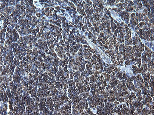 CD74 / CLIP Antibody (clone OTI1H3)
