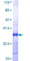 Human CBX2 Protein (Recombinant GST, N-terminus)