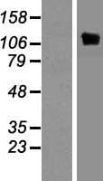 Human PTK2B / PYK2 Protein (Over-Expression Lysate Myc-DDK (Flag))