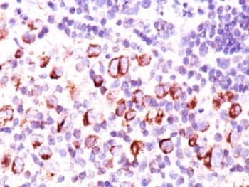 BCL2L1 / BCL-XL Antibody (aa3-14, clone BX006 + 2H12, Ready-to-Use)