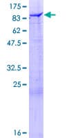 Human DSTYK / RIPK5 Protein (Recombinant GST)