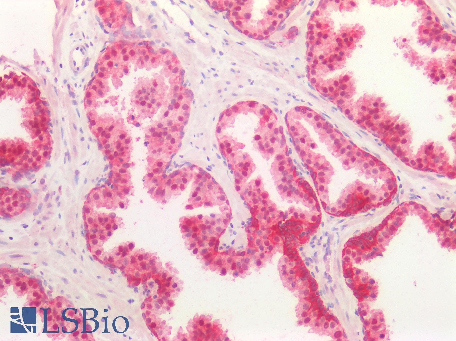 IHC-plus™ Polyclonal Rabbit anti-Human TGFB2 / TGF Beta2 Antibody (aa304-413, IHC, WB)