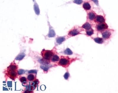 IHC-plus™ Polyclonal Rabbit anti-Human SIPR2 / S1P2 / EDG5 Antibody (C-Terminus, IHC)