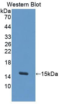 S100A7A / S100A15 Antibody (aa2-101, Biotin)