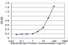 Monoclonal Mouse anti-Human CD8A / CD8 Alpha Antibody (clone 4B9)