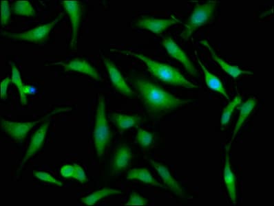 OTUD7B / Cezanne Antibody