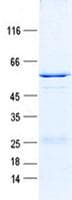 Human STX6 / Syntaxin 6 Protein (Recombinant GST, N-terminus + His, C-terminus)