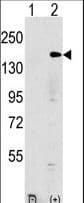Polyclonal Rabbit anti-Human EHMT1 Antibody (aa203-233, WB)