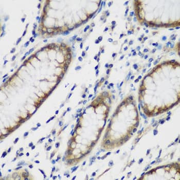 Polyclonal Rabbit anti-Human TTBK2 Antibody (IHC, IF, WB)