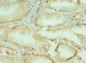 Polyclonal Rabbit anti-Human COL10A1 / Collagen X Antibody (aa521-680, IHC)